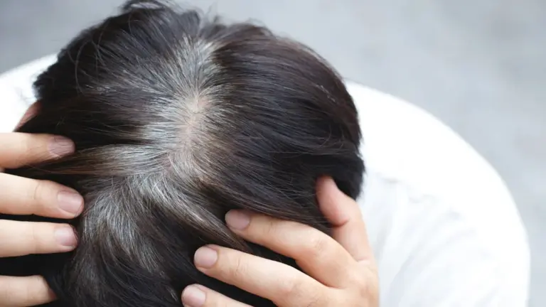 Capelli bianchi alle radici: come nasconderli senza tinte è il segreto di bellezza che tutte vorranno sapere