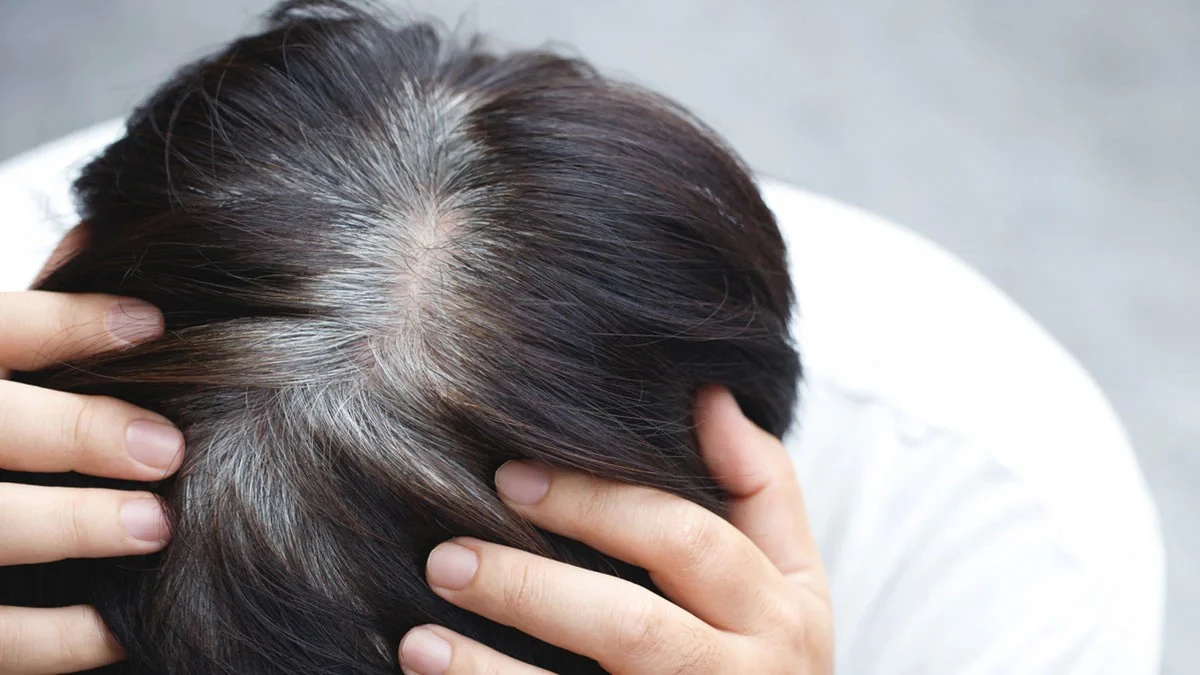 Capelli bianchi alle radici: come nasconderli senza tinte è il segreto di bellezza che tutte vorranno sapere