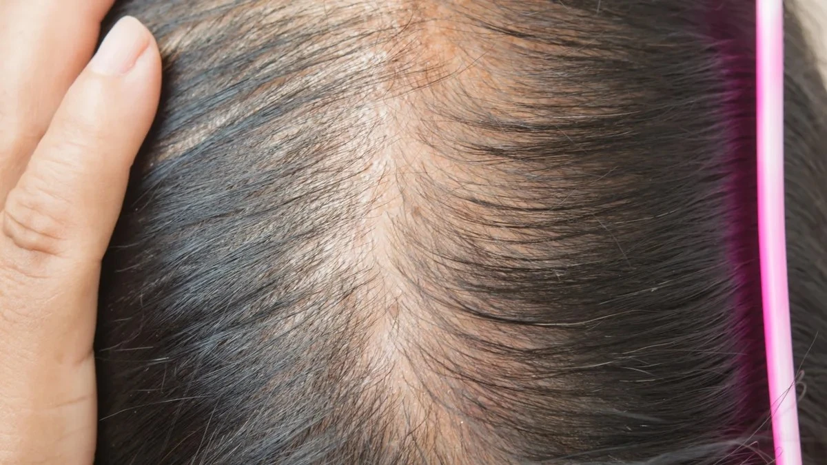 Capelli più folti: la tricologa svela 3 segreti per rinforzare anche i capelli più fini