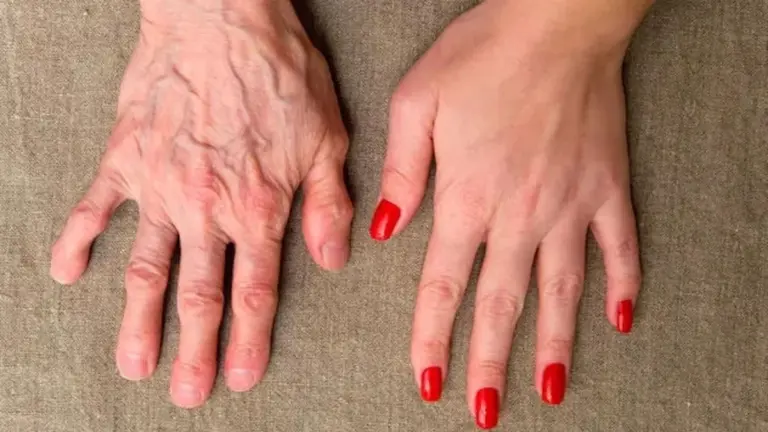 Mani Secche e Rughe Precoce? 5 Segreti per una Pelle Vellutata che Nessuno Ti Ha Mai Svelato